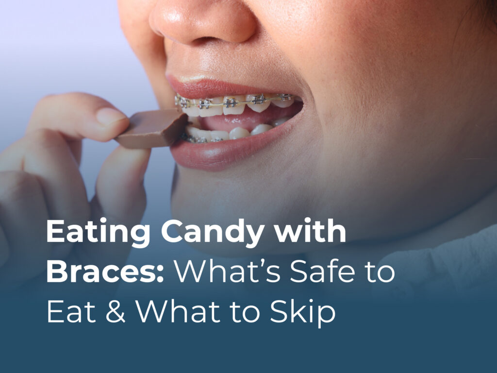 eating candy with braces what's safe to eat and what to skip