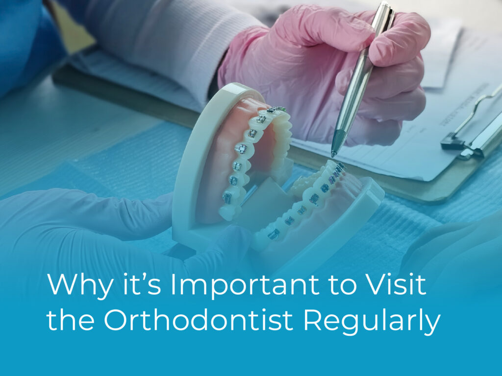 Why it's Important to Visit the Orthodontist Regularly